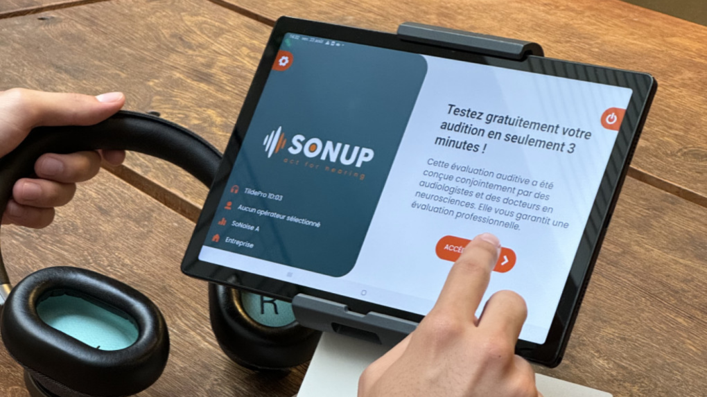 sonup